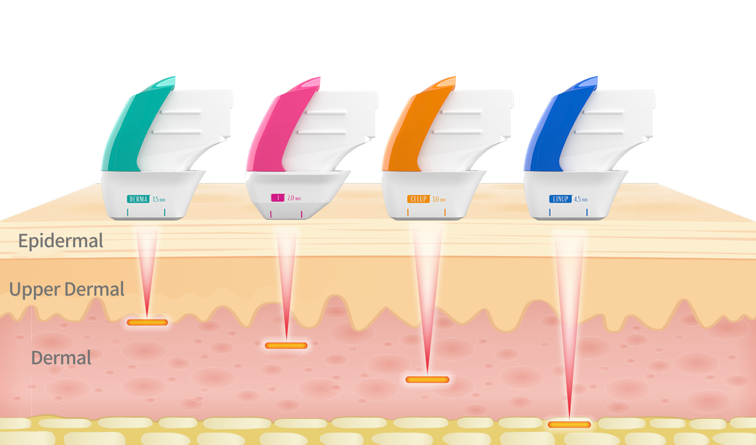 Image illustrating the skin structure showing the transmission of ultrasound energy from the epidermis to the dermis and SMAS layers.