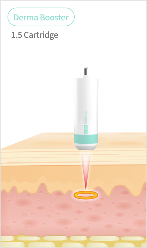 Shrink Universe cartridge guide image comparing various cartridges from 1.5mm to 4.5mm
