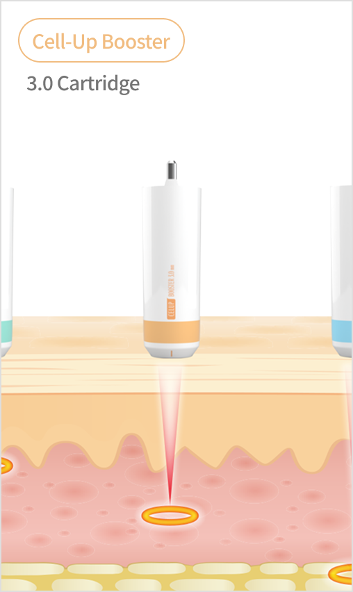 Shrink Universe cartridge guide image comparing various cartridges from 1.5mm to 4.5mm
