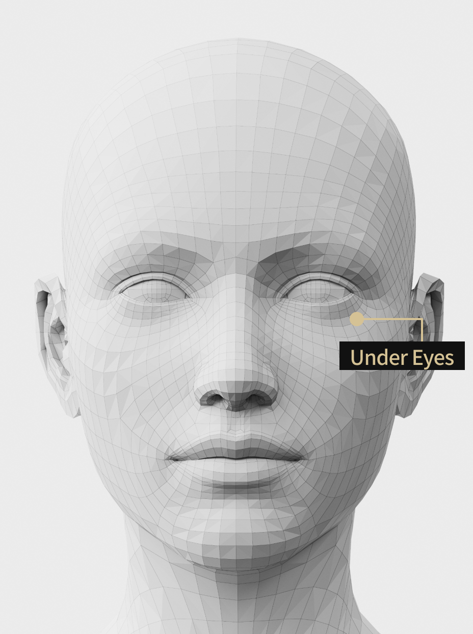 Image description of Botox treatment areas to improve under-eye wrinkles and elasticity