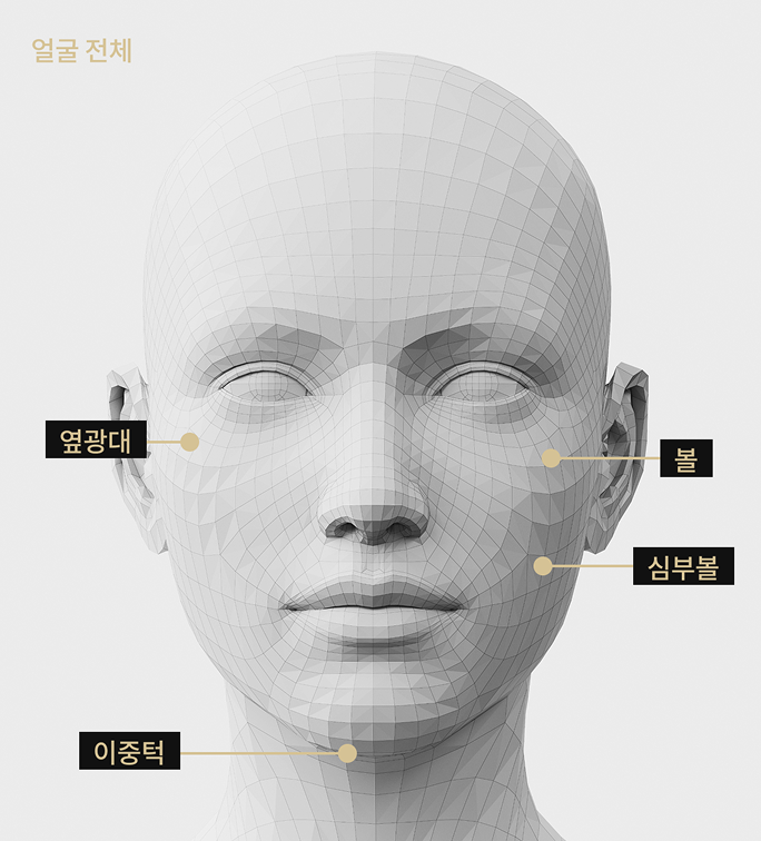 온다 리프팅 적용 부위를 표시한 3D 얼굴 모델 이미지
