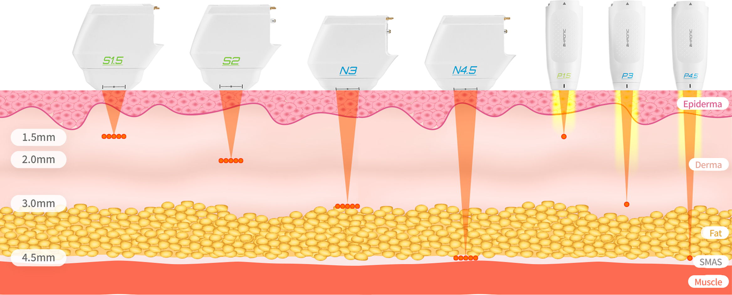 Image showing the types of V-lifting cartridges, including FL cartridges and SD cartridges.