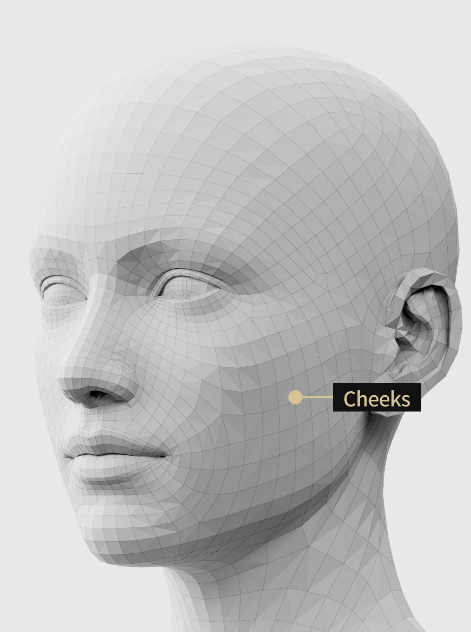 Image of cheek filler procedure to fill in the hollow areas of the cheeks to create a youthful impression