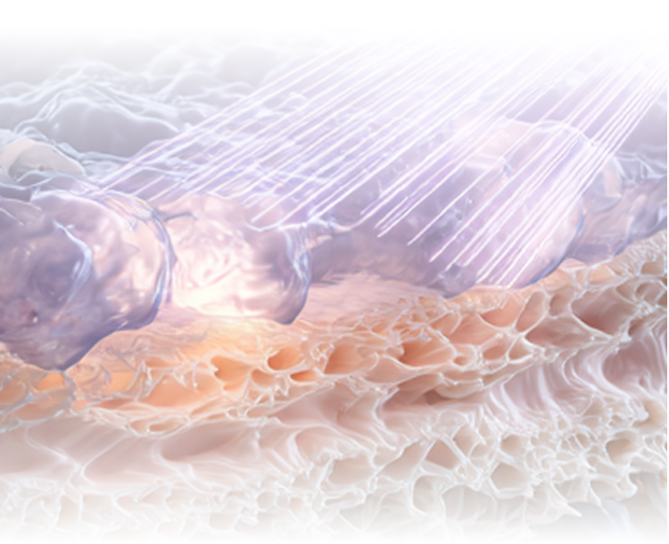 세 가지 파장을 동시에 사용하는 티타늄 리프팅 장비의 시술 콘셉트를 설명하는 이미지