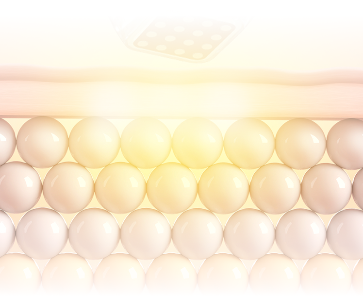 皮膚の状態に合わせて高周波エネルギーを伝達するポテンザレーザー手術コンセプトイメージ