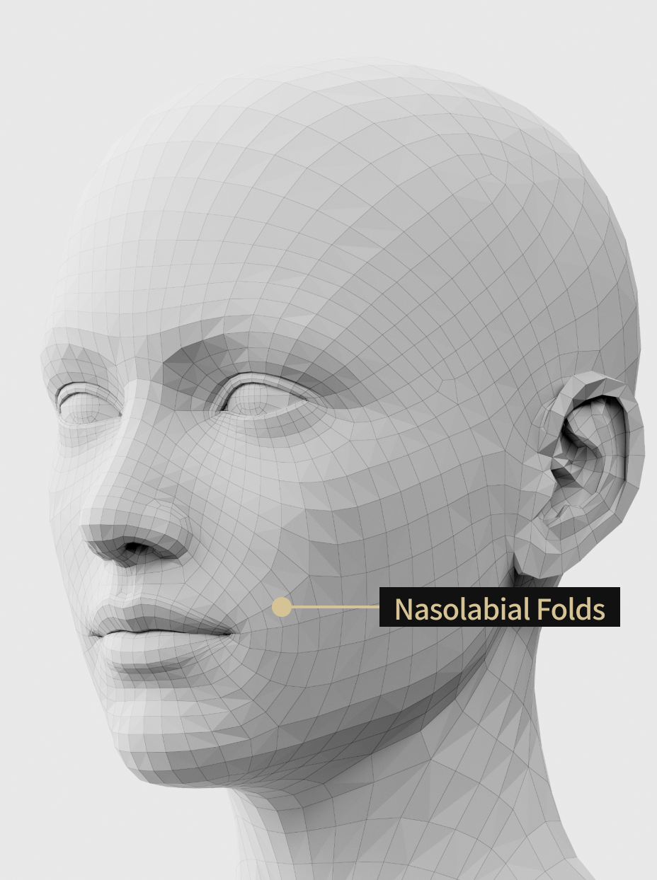 Image description of a filler procedure that fills in the nasolabial folds and alleviates the appearance of aged facial features.