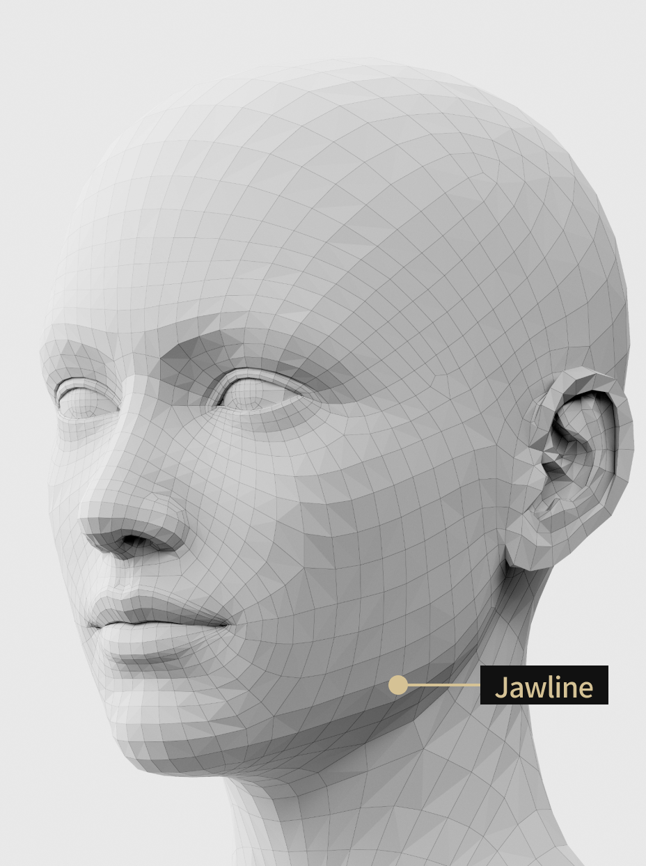 Image of jawline filler treatment to smooth out sagging and sunken jawline under the ears.