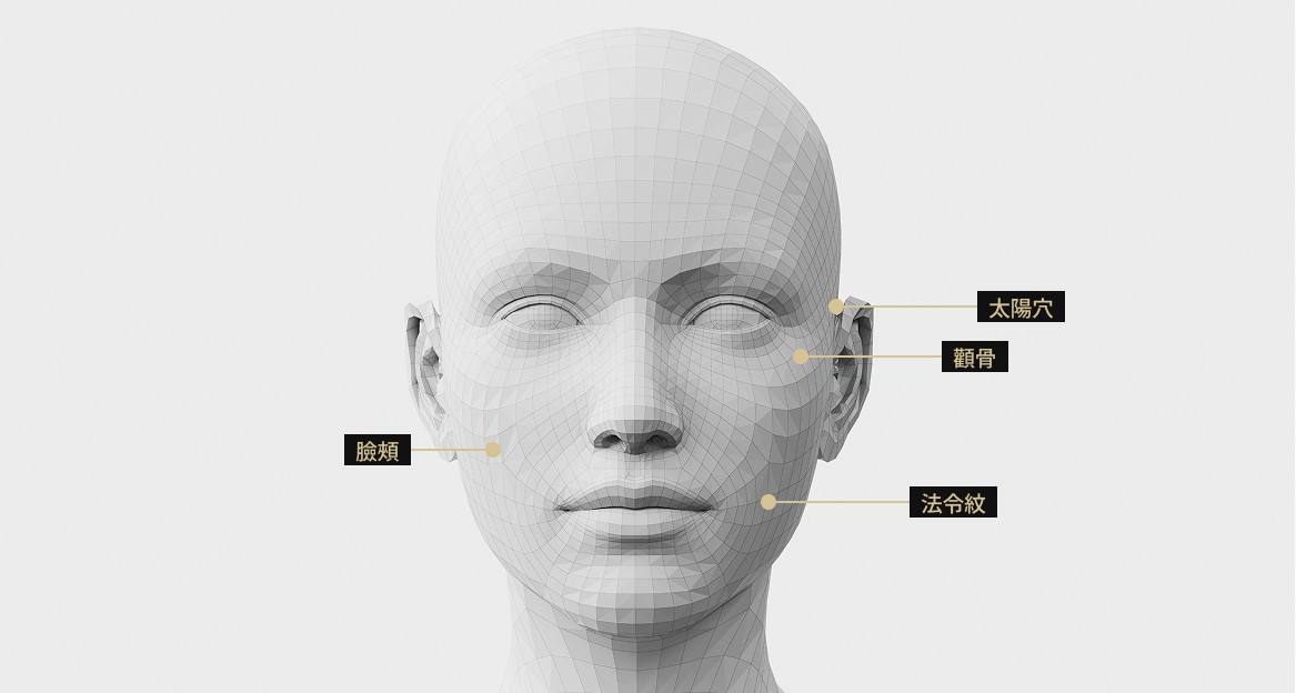 3D臉部模型影像顯示了Sculptra注射部位。
