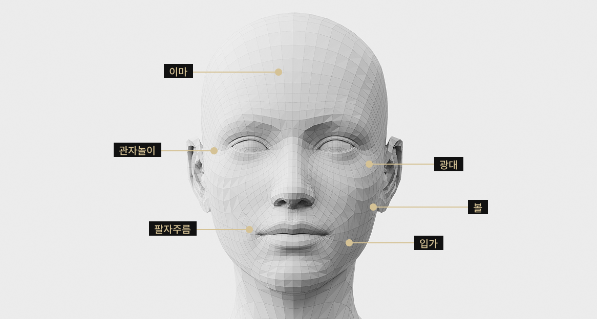 관자, 앞볼, 앞광대, 팔자, 입가, 볼 등 쥬베룩 볼륨 시술 부위를 표시한 얼굴 모델 이미지