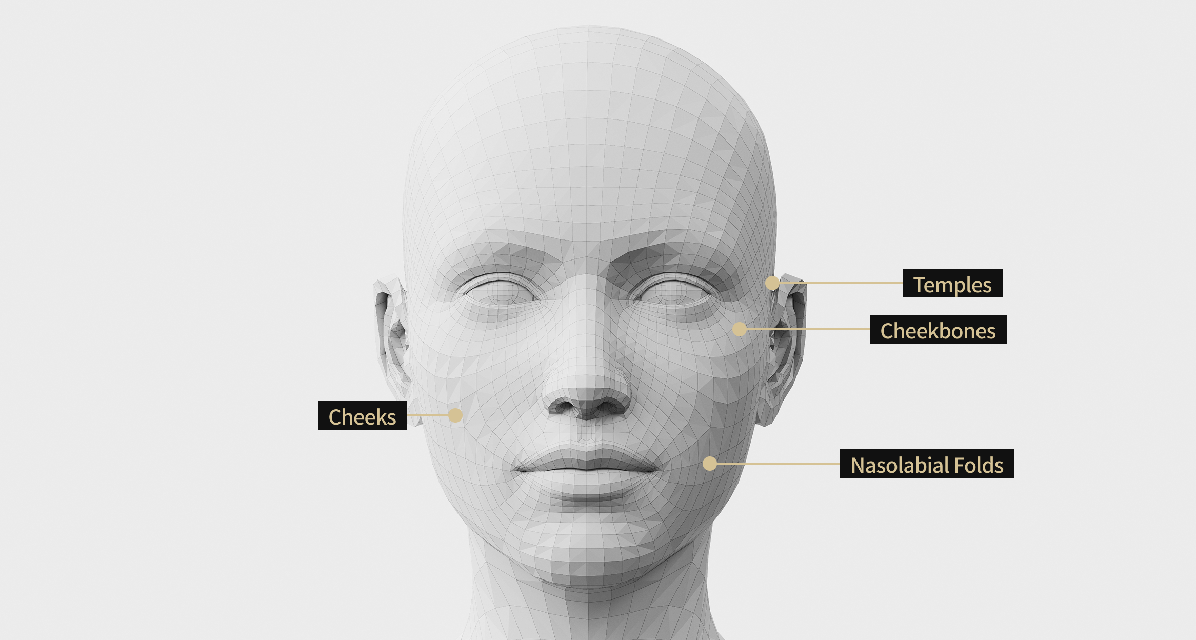 3D facial model image showing the areas where Sculptra was applied