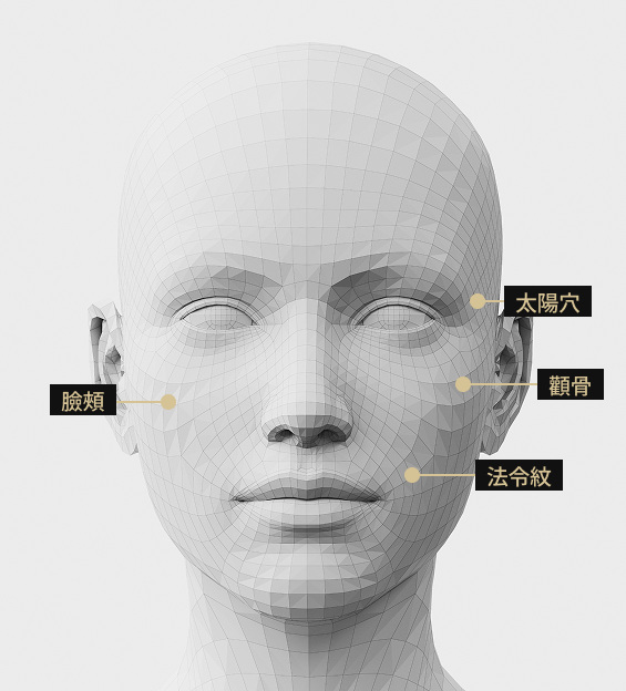 3D臉部模型影像顯示了Sculptra注射部位。