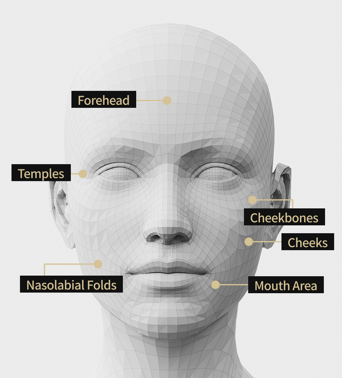 Face model image showing the areas where Juvelook volume treatment was performed, including the temples, forehead, forehead, nasolabial folds, corners of the mouth, and cheeks.
