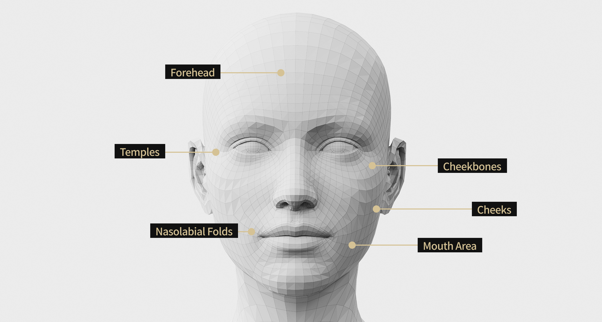 Face model image showing the areas where Juvelook volume treatment was performed, including the temples, forehead, forehead, nasolabial folds, corners of the mouth, and cheeks.