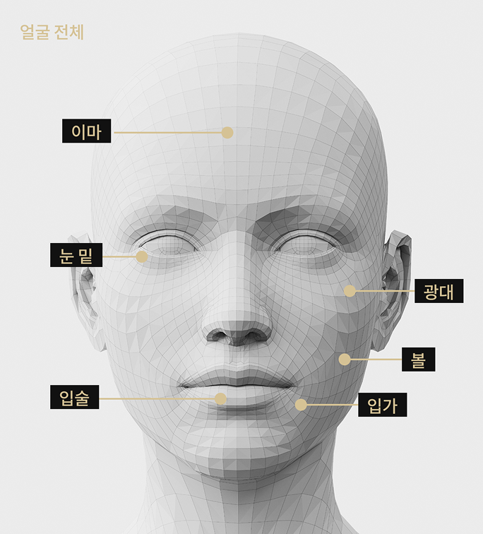 관자, 앞볼, 앞광대, 팔자, 입가, 볼 등 쥬베룩 볼륨 시술 부위를 표시한 얼굴 모델 이미지