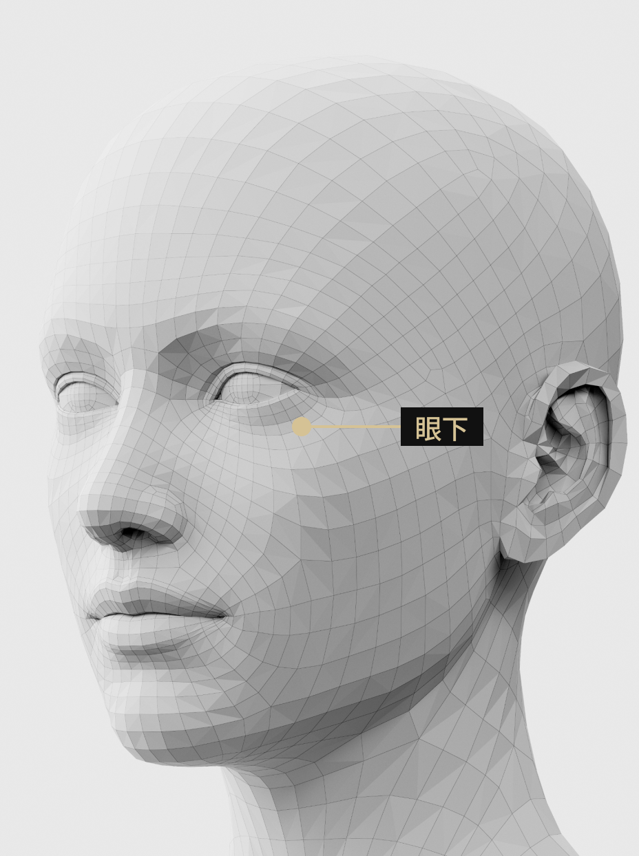 图片描述：眼下填充剂注射部位，用于改善眼下凹陷和下垂。