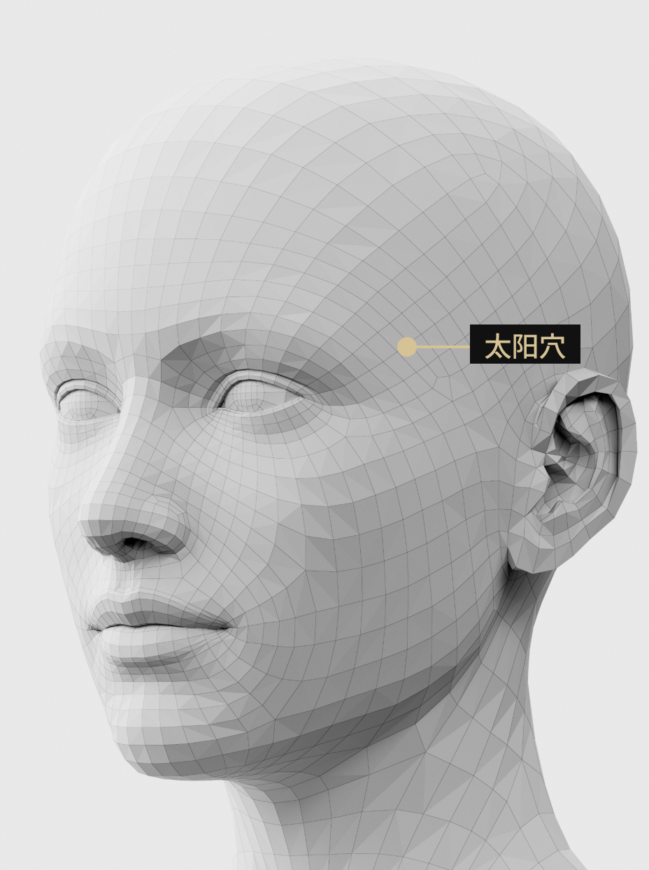 图片展示了通过填满太阳穴部位来改善太阳穴下垂、使面部线条更加流畅的疗程。
