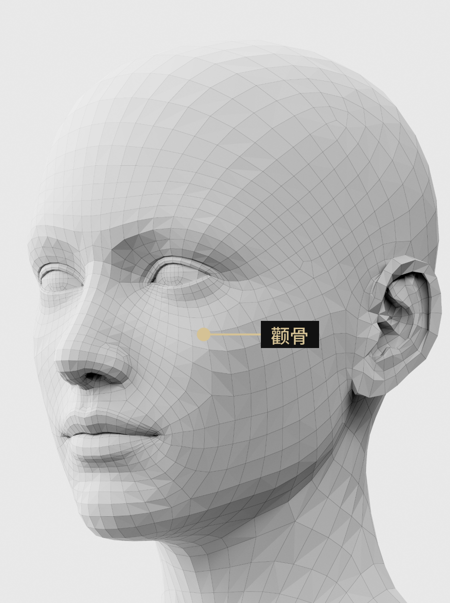 图片显示了填充治疗如何增加颧骨的体积，从而打造立体的面部轮廓。